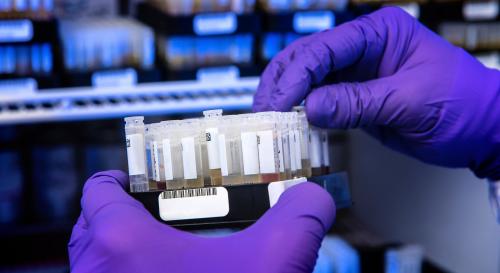 Gloved hands holding patient samples for testing